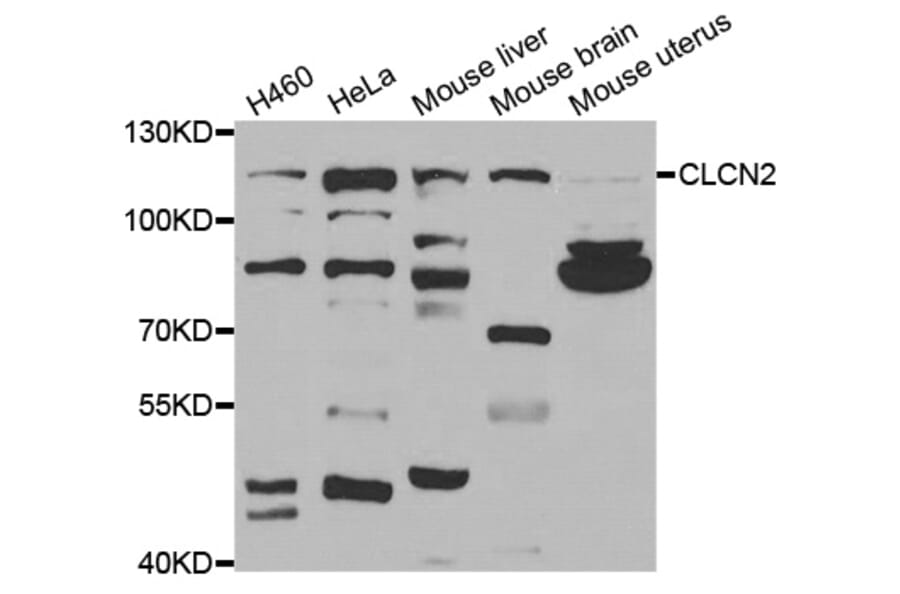 Anti-CLCN2 Antibody from Bioworld Technology (BS7915) - Antibodies.com