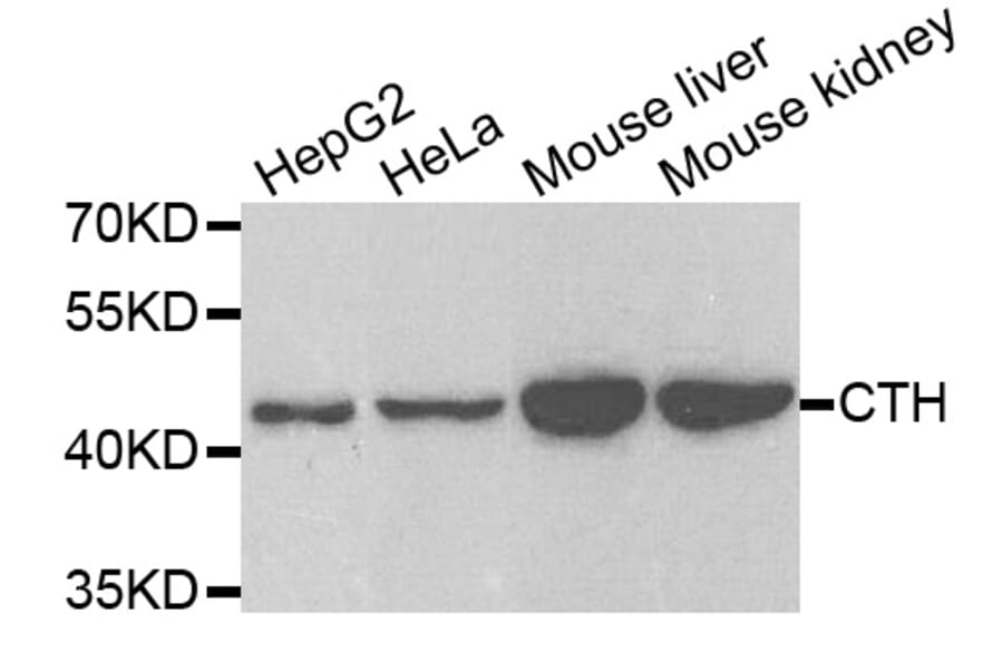 Anti-CTH Antibody from Bioworld Technology (BS7916) - Antibodies.com