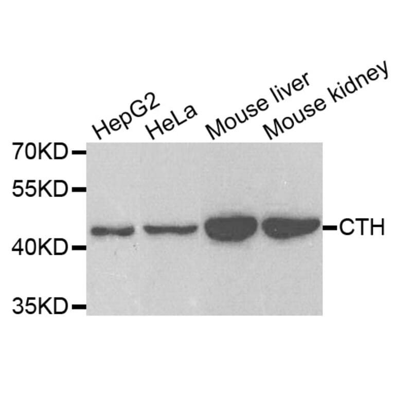 Anti-CTH Antibody from Bioworld Technology (BS7916) - Antibodies.com
