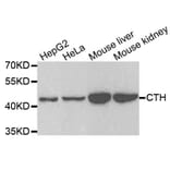 Anti-CTH Antibody from Bioworld Technology (BS7916) - Antibodies.com