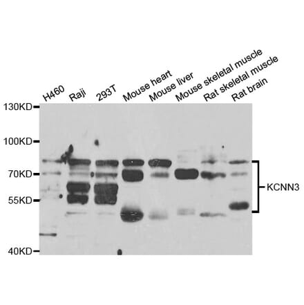 Anti-KCNN3 Antibody from Bioworld Technology (BS7920) - Antibodies.com