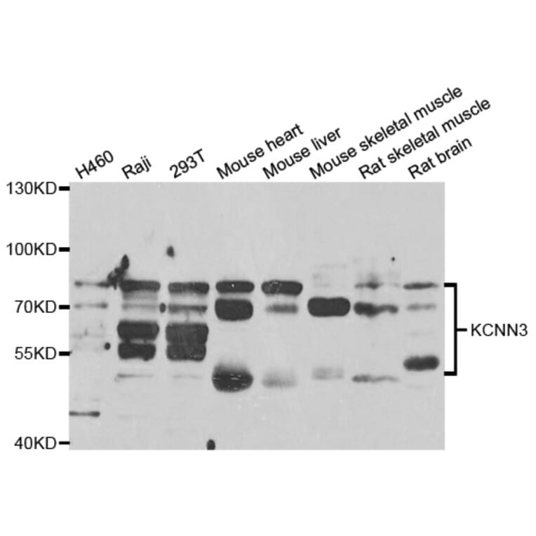 Anti-KCNN3 Antibody from Bioworld Technology (BS7920) - Antibodies.com