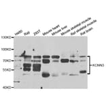 Anti-KCNN3 Antibody from Bioworld Technology (BS7920) - Antibodies.com