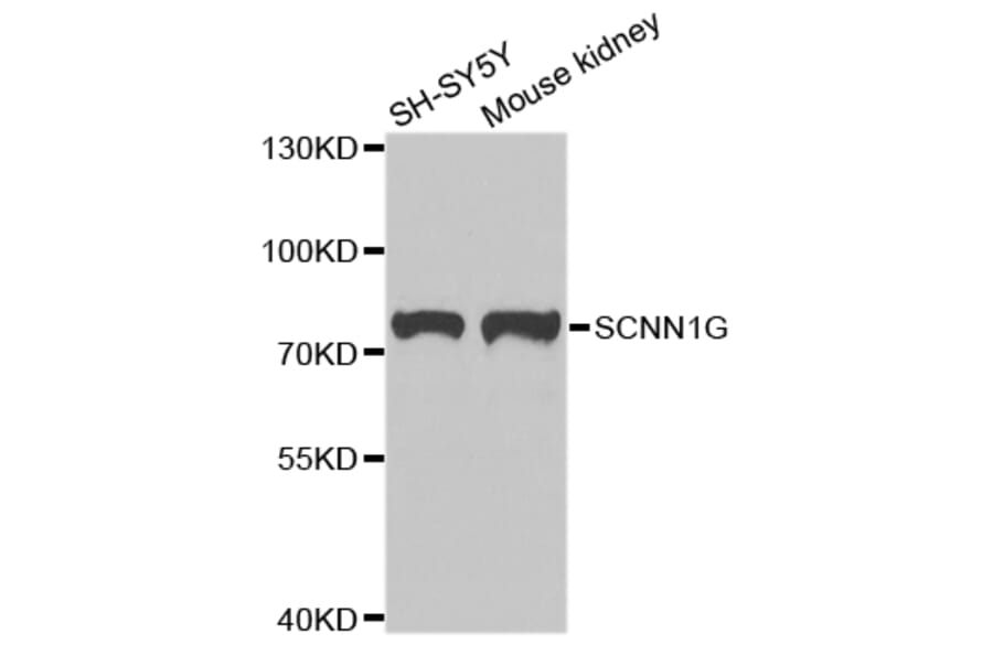 Anti-SCNN1G Antibody from Bioworld Technology (BS7921) - Antibodies.com