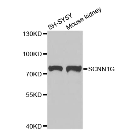 Anti-SCNN1G Antibody from Bioworld Technology (BS7921) - Antibodies.com