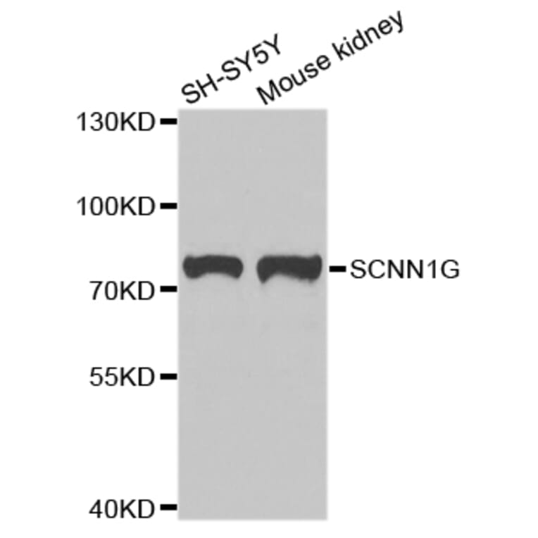 Anti-SCNN1G Antibody from Bioworld Technology (BS7921) - Antibodies.com