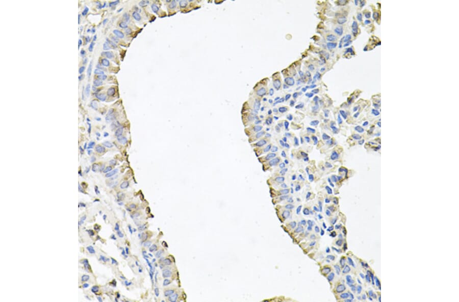 Anti-SCNN1G Antibody from Bioworld Technology (BS7921) - Antibodies.com