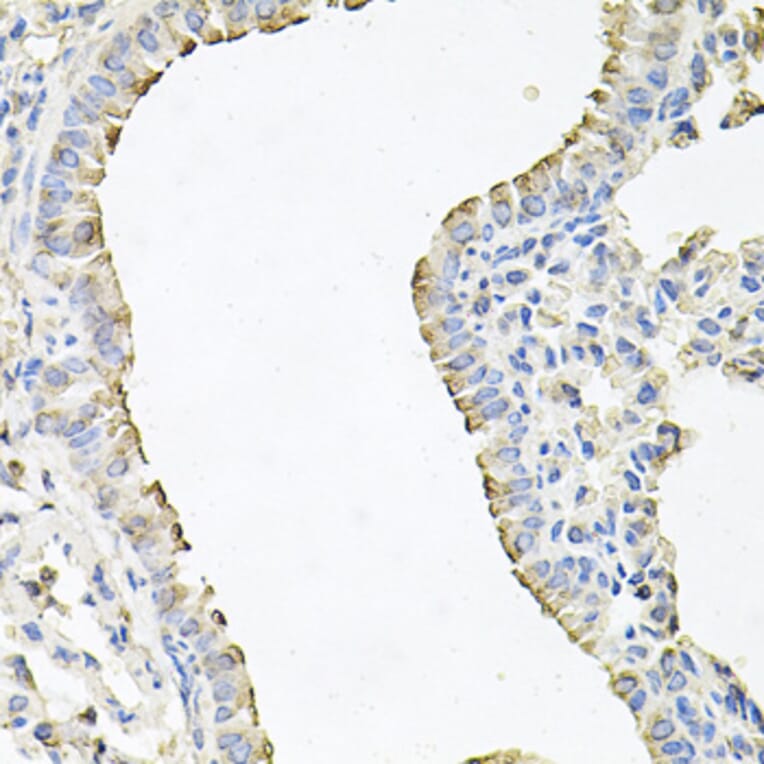 Anti-SCNN1G Antibody from Bioworld Technology (BS7921) - Antibodies.com