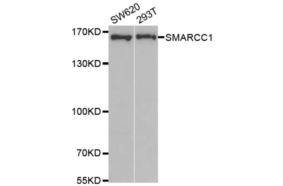 Anti-SMARCC1 Antibody from Bioworld Technology (BS7923) - Antibodies.com