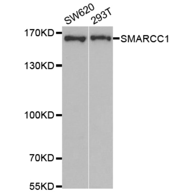 Anti-SMARCC1 Antibody from Bioworld Technology (BS7923) - Antibodies.com