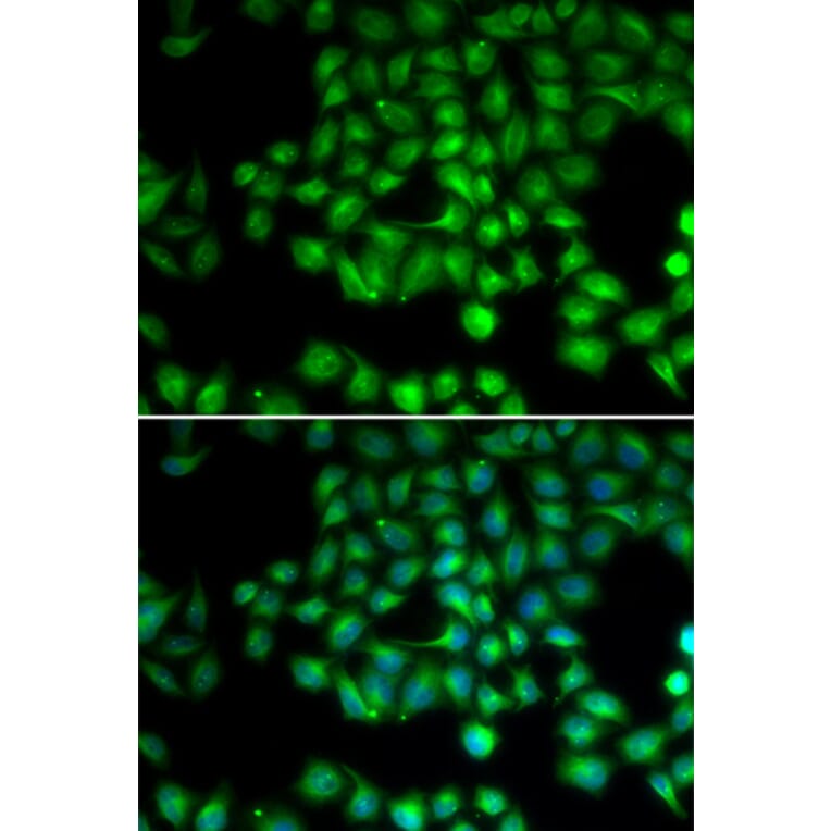 Anti-TRPM2 Antibody from Bioworld Technology (BS7930) - Antibodies.com