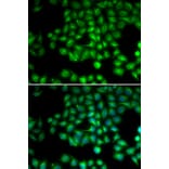 Anti-TRPM2 Antibody from Bioworld Technology (BS7930) - Antibodies.com