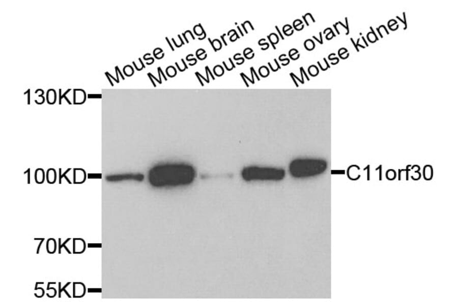 Anti-C11orf30 Antibody from Bioworld Technology (BS7931) - Antibodies.com