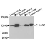 Anti-C11orf30 Antibody from Bioworld Technology (BS7931) - Antibodies.com