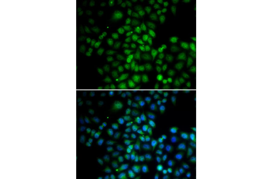 Anti-C11orf30 Antibody from Bioworld Technology (BS7931) - Antibodies.com