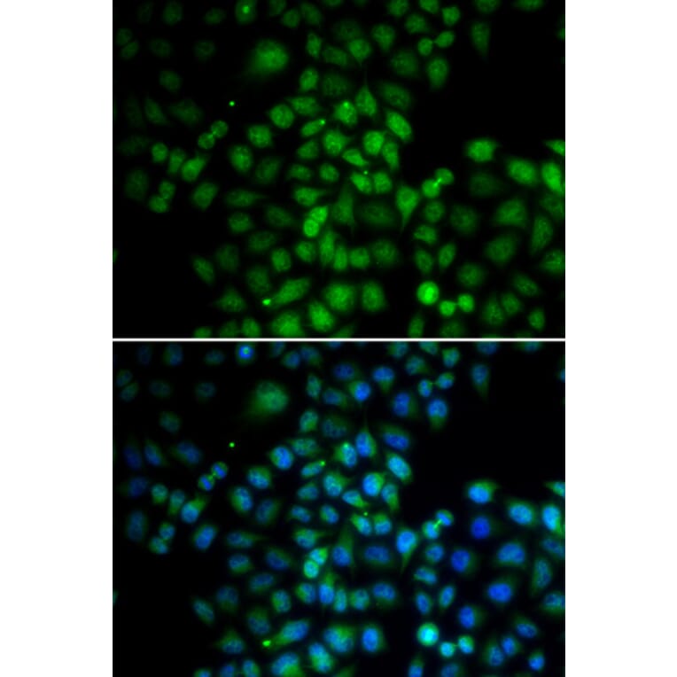 Anti-C11orf30 Antibody from Bioworld Technology (BS7931) - Antibodies.com