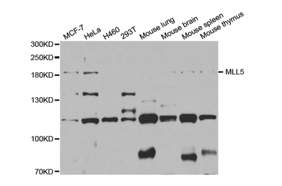 Anti-MLL5 Antibody from Bioworld Technology (BS7935) - Antibodies.com
