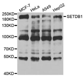 Anti-SETDB1 Antibody from Bioworld Technology (BS7938) - Antibodies.com