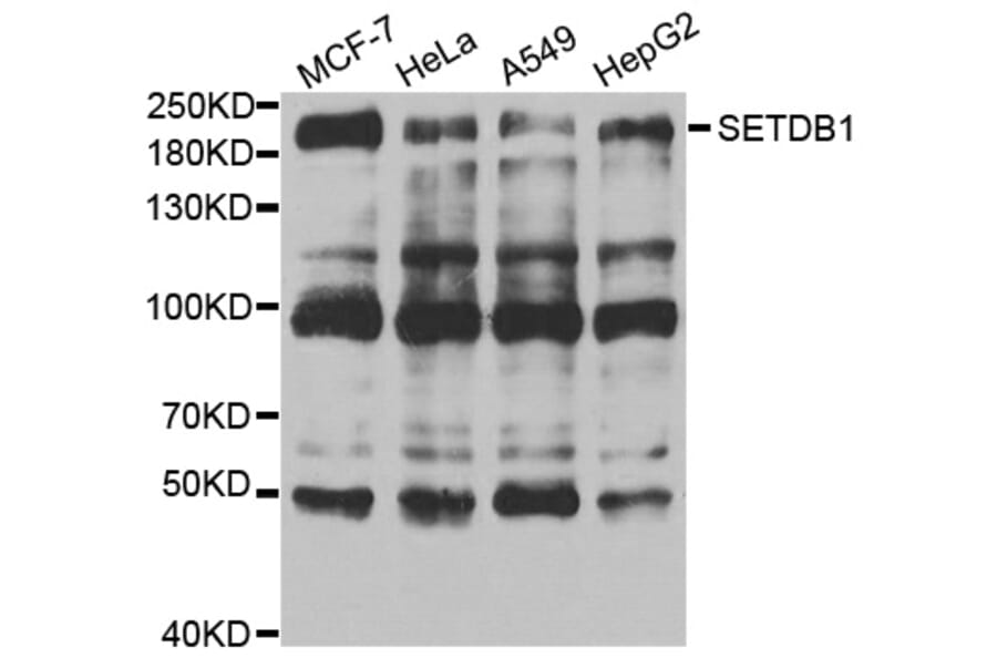 Anti-SETDB1 Antibody from Bioworld Technology (BS7938) - Antibodies.com