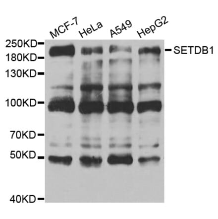 Anti-SETDB1 Antibody from Bioworld Technology (BS7938) - Antibodies.com
