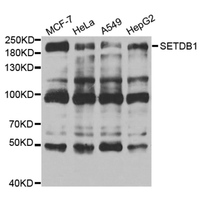 Anti-SETDB1 Antibody from Bioworld Technology (BS7938) - Antibodies.com