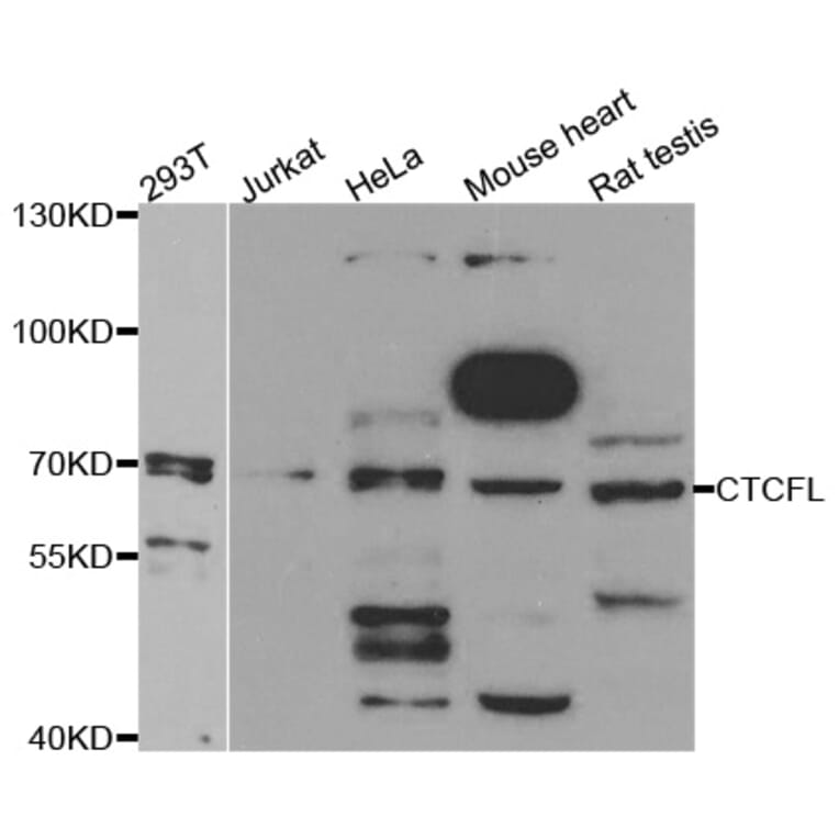 Anti-CTCFL Antibody from Bioworld Technology (BS7940) - Antibodies.com