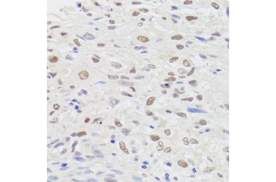 Anti-HMGN1 Antibody from Bioworld Technology (BS7944) - Antibodies.com