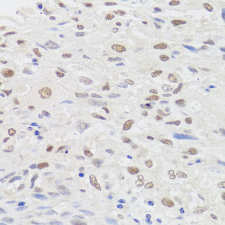 Anti-HMGN1 Antibody from Bioworld Technology (BS7944) - Antibodies.com