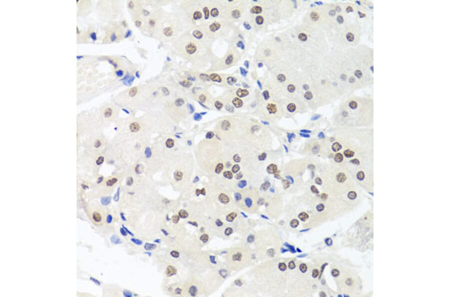 Anti-HMGN1 Antibody from Bioworld Technology (BS7944) - Antibodies.com
