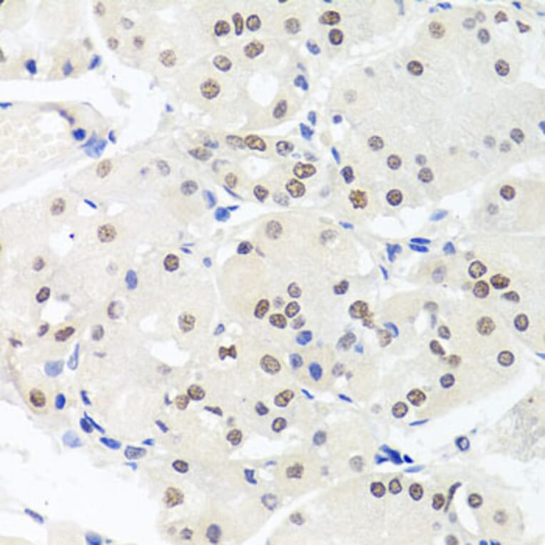 Anti-HMGN1 Antibody from Bioworld Technology (BS7944) - Antibodies.com
