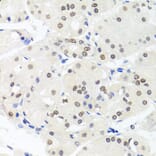 Anti-HMGN1 Antibody from Bioworld Technology (BS7944) - Antibodies.com