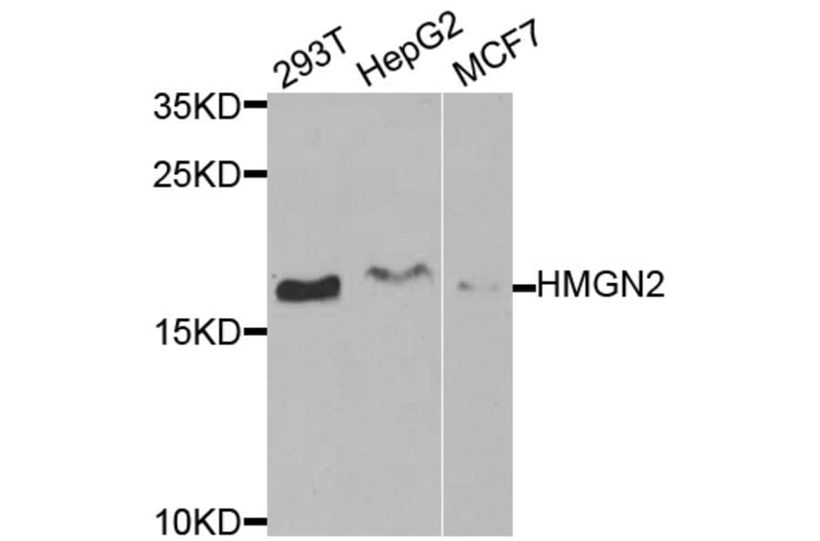 Anti-HMGN2 Antibody from Bioworld Technology (BS7945) - Antibodies.com