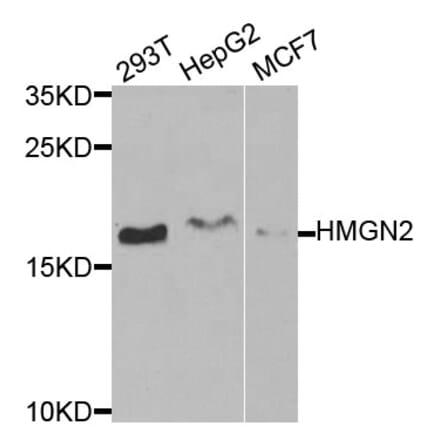 Anti-HMGN2 Antibody from Bioworld Technology (BS7945) - Antibodies.com