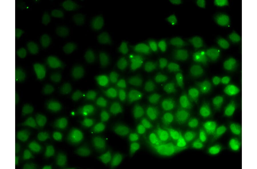 Anti-HMGN2 Antibody from Bioworld Technology (BS7945) - Antibodies.com