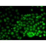Anti-HMGN2 Antibody from Bioworld Technology (BS7945) - Antibodies.com