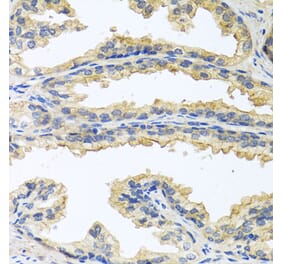 Anti-OSM Antibody from Bioworld Technology (BS7949) - Antibodies.com
