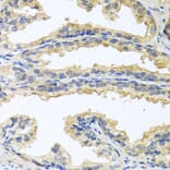 Anti-OSM Antibody from Bioworld Technology (BS7949) - Antibodies.com