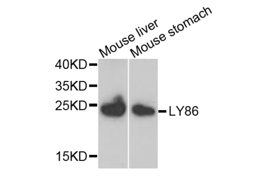 Anti-LY86 Antibody from Bioworld Technology (BS7951) - Antibodies.com