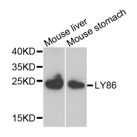 Anti-LY86 Antibody from Bioworld Technology (BS7951) - Antibodies.com