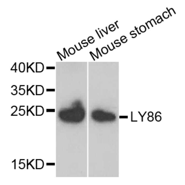 Anti-LY86 Antibody from Bioworld Technology (BS7951) - Antibodies.com