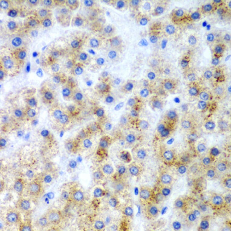 Anti-LY86 Antibody from Bioworld Technology (BS7951) - Antibodies.com