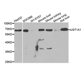 Anti-UGT1A1 Antibody from Bioworld Technology (BS7952) - Antibodies.com