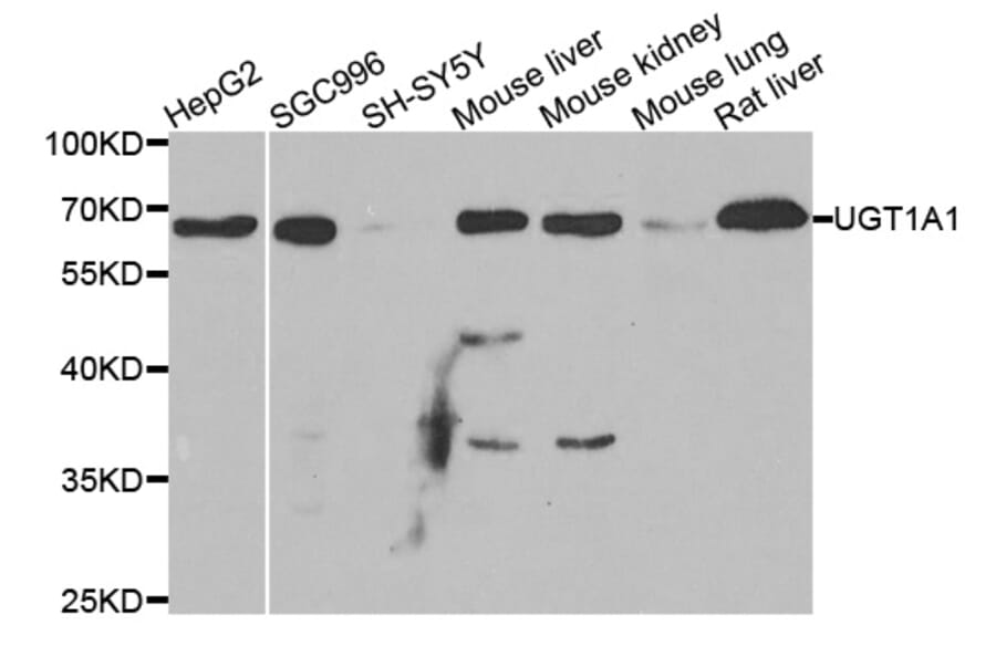 Anti-UGT1A1 Antibody from Bioworld Technology (BS7952) - Antibodies.com