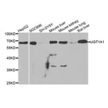 Anti-UGT1A1 Antibody from Bioworld Technology (BS7952) - Antibodies.com
