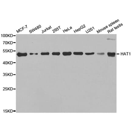 Anti-HAT1 Antibody from Bioworld Technology (BS7954) - Antibodies.com