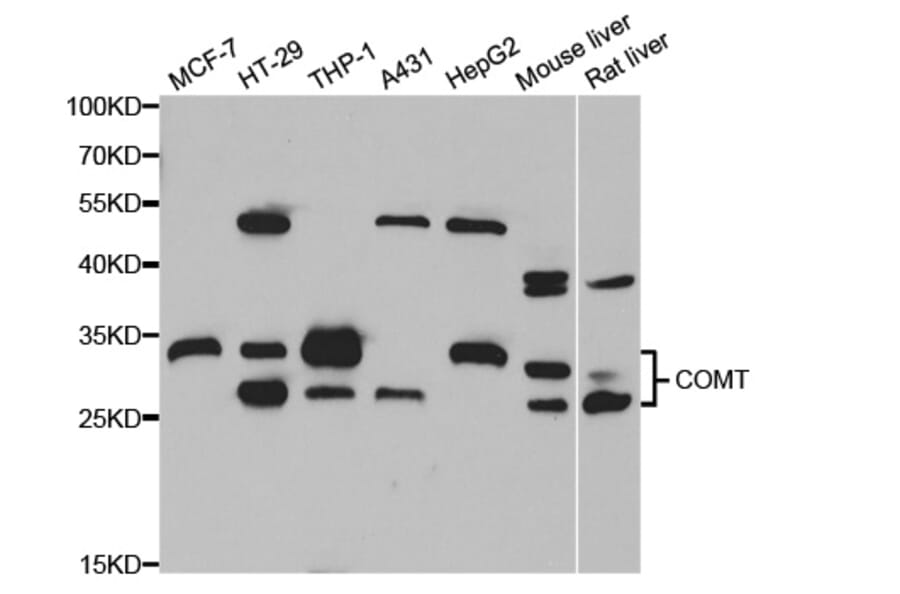 Anti-COMT Antibody from Bioworld Technology (BS7956) - Antibodies.com