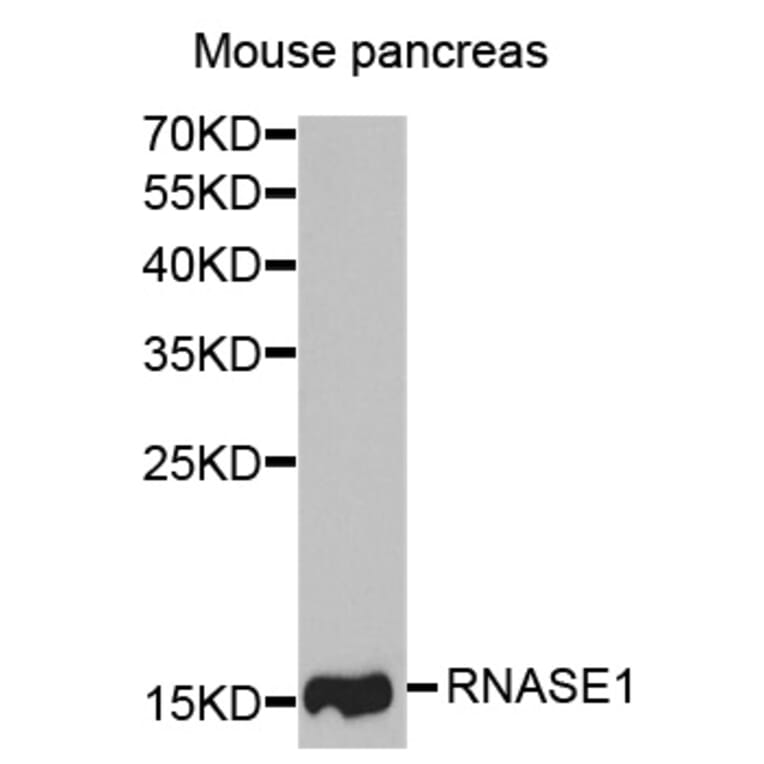 Anti-RNASE1 Antibody from Bioworld Technology (BS7958) - Antibodies.com