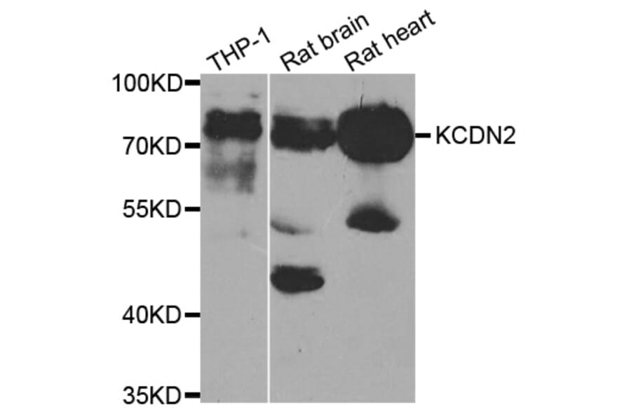 Anti-KV4.2 Antibody from Bioworld Technology (BS7959) - Antibodies.com