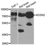 Anti-KV4.2 Antibody from Bioworld Technology (BS7959) - Antibodies.com