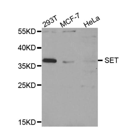Anti-SET Antibody from Bioworld Technology (BS7964) - Antibodies.com